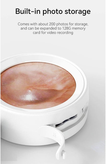 Digital Otoscope Camera with HD Display & LED Lights