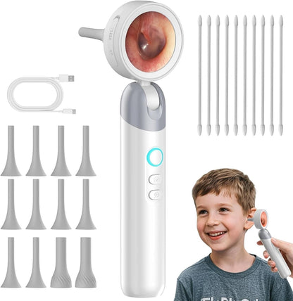 Digital Otoscope Camera with HD Display & LED Lights