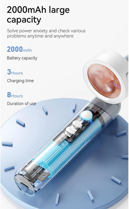 Digital Otoscope Camera with HD Display & LED Lights