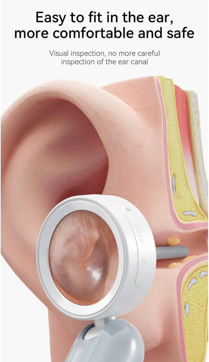 Digital Otoscope Camera with HD Display & LED Lights