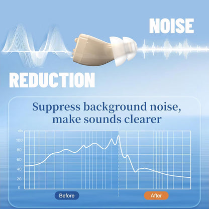 Digital Rechargeable Hearing Amplifiers with Charging Case, Invisible Hearing Amplifiers for Seniors, Long-Lasting Battery, Easy to Use (Beige)